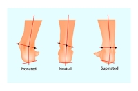 Causes and Complications of Supination